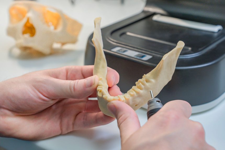 Técnico refina um modelo dentário produzido em impressora 3D em um laboratório.